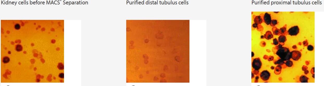 Human kidney cell subsets isolated by using an anti-Tamm-Horsefall glycoprotein antibody for distal tubulus cells and a CD13 antibody for proximal tubulus cells in combination with Anti-Mouse IgG1 MicroBeads. (Courtesy of Dr. Baer, Frankfurt a.M., Germany.)